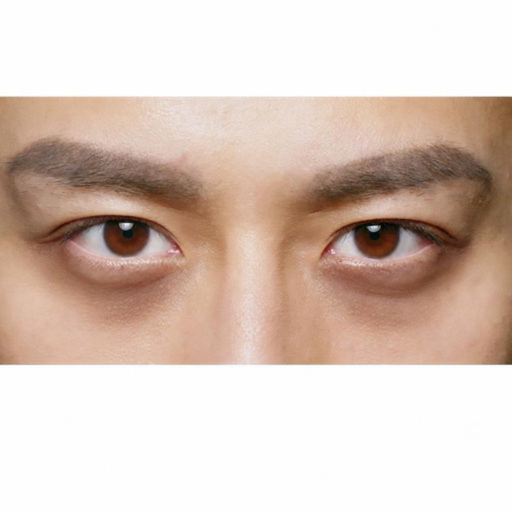 黑眼圈深暗示意圖